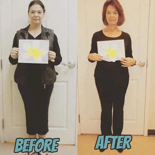Before and after result