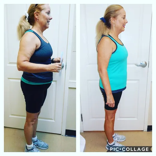 Before and after result