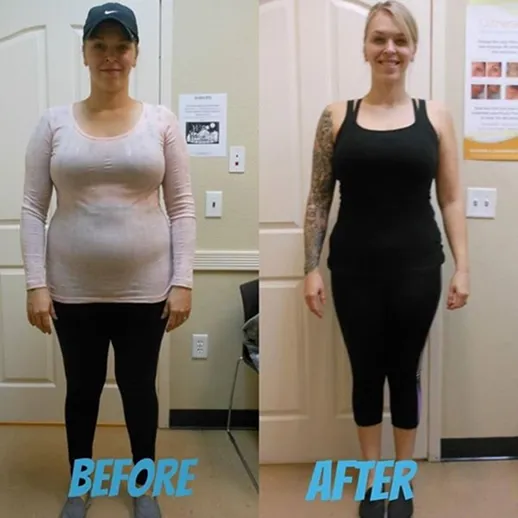 Before and after result