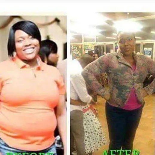 Before and after result