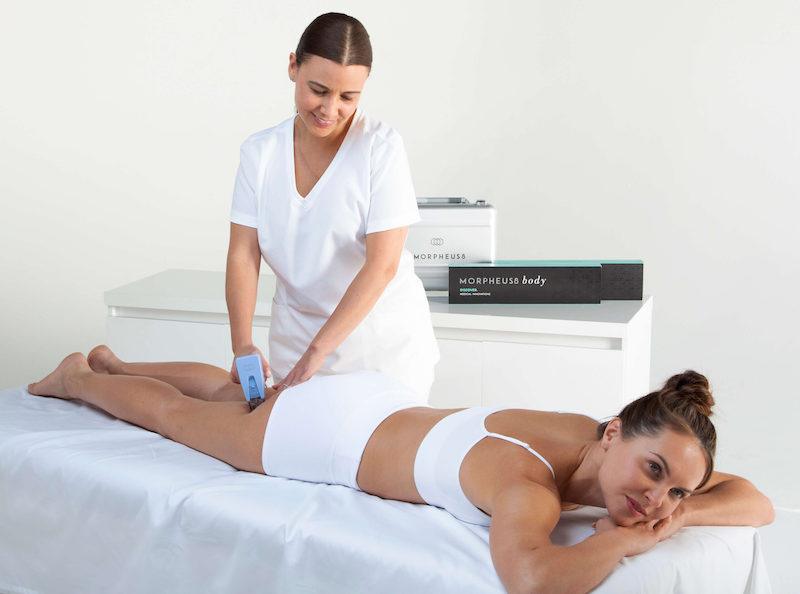 Morpheus8 Body Treatment