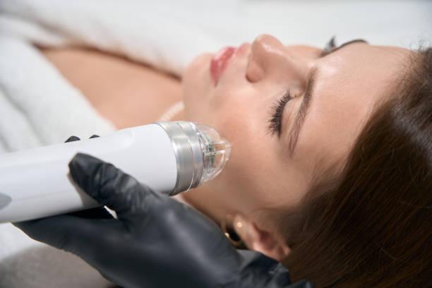 Can I Wear Makeup After RF Microneedling
