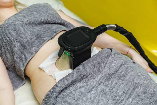 Woman getting cryolipolysis fat treatment procedure in beauty salon