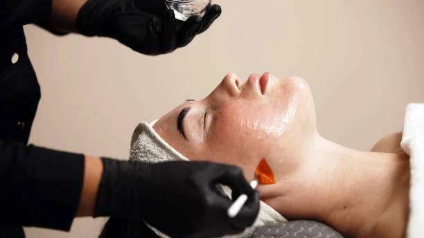 Do Chemical Peels Help With Wrinkles​