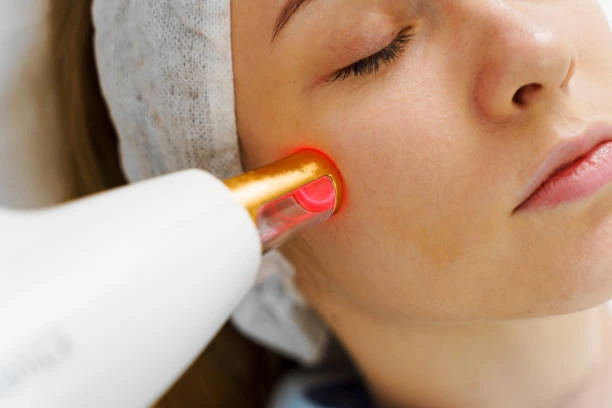 How Long Do Laser-Spider Vein Results Last