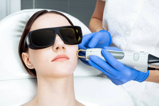 How Many IPL Photofacial Sessions Do I Need
