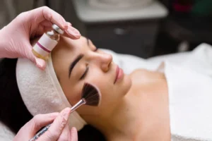 Chemical Peels Summerlin