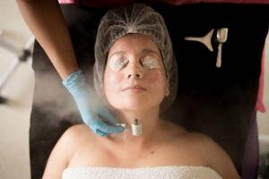 Cryofacial Costa Mesa