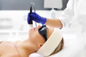 Erbium Laser Costa Mesa