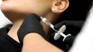 JUVÉDERM Fillers San Marcos