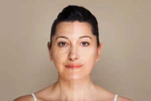 Jeuveau Injections Costa Mesa