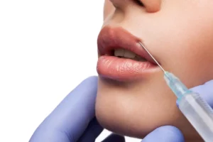 San Marcos Dermal Fillers Juvederm