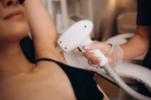 Laser Hair Removal Treatment