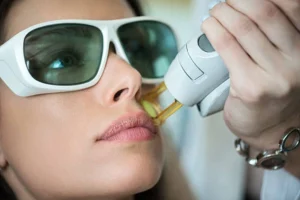 Laser Hair Removal Summerlin