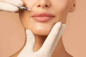 Lip Filler Costa Mesa