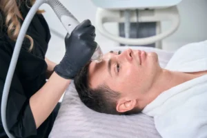 RF Microneedling Summerlin