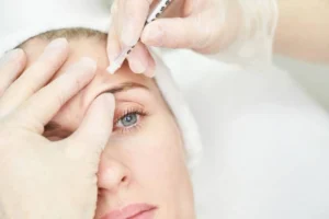 Restylane Filler Costa Mesa