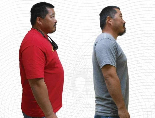 Las Vegas HCG Injections services at TrimBody M.D.