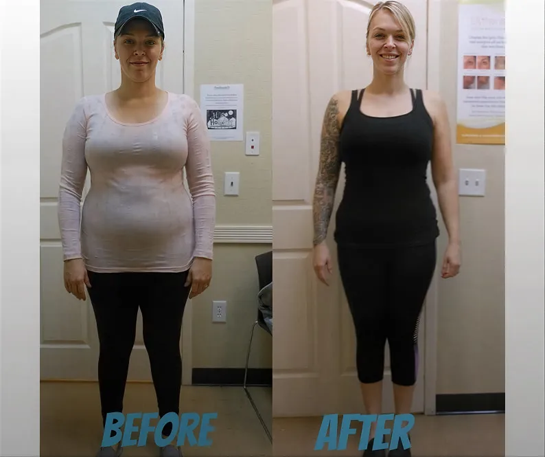 Before & after 4