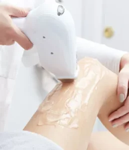 Hair Laser Removal image