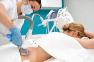 Cryobody Contouring Costa Mesa