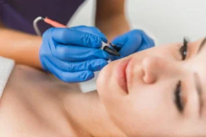 Electrolysis Vs Laser Hair Removal