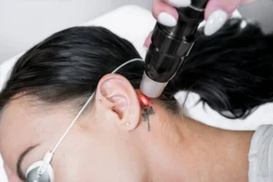 How many sessions of laser tattoo removal