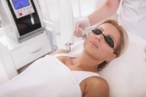 IPL Photofacial Henderson