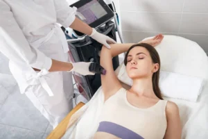 Microneedling with PRP Henderson