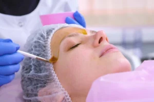 Do Chemical Peels Hurt