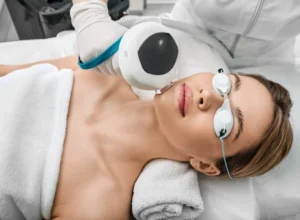 IPL Photofacial Costa Mesa
