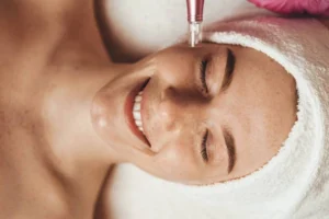Microneedling Costa Mesa