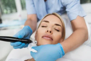 Microneedling with PRP Newport Beach