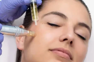 Microneedling with PRP Summerlin